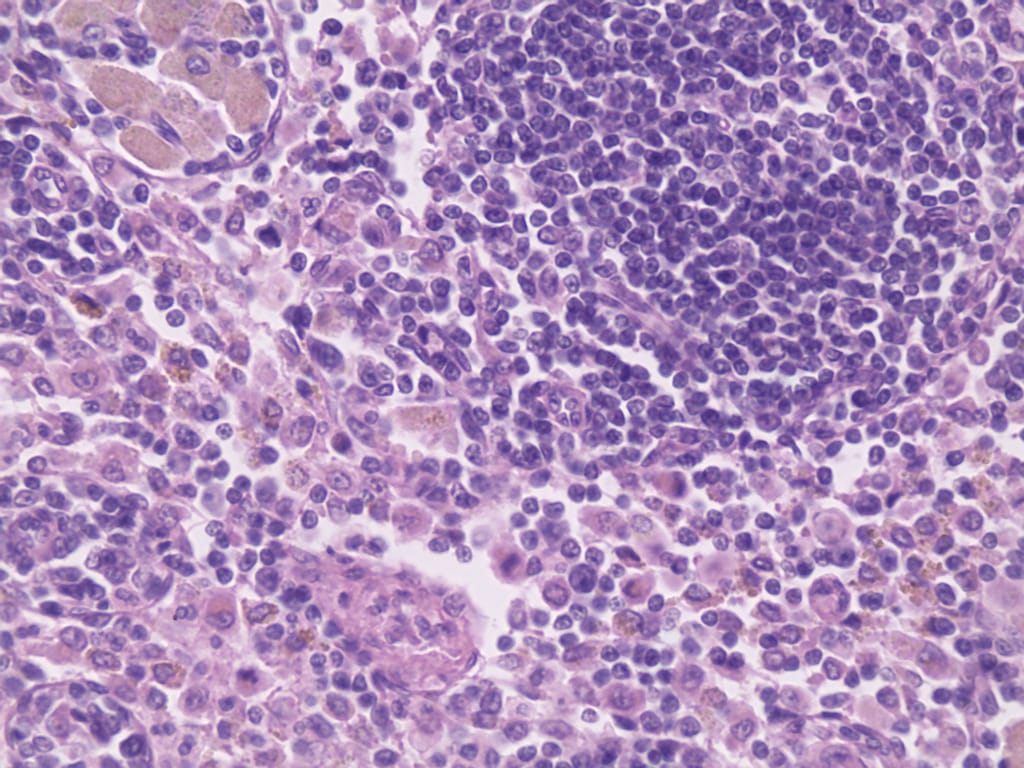 Lymph Node, Human Slide