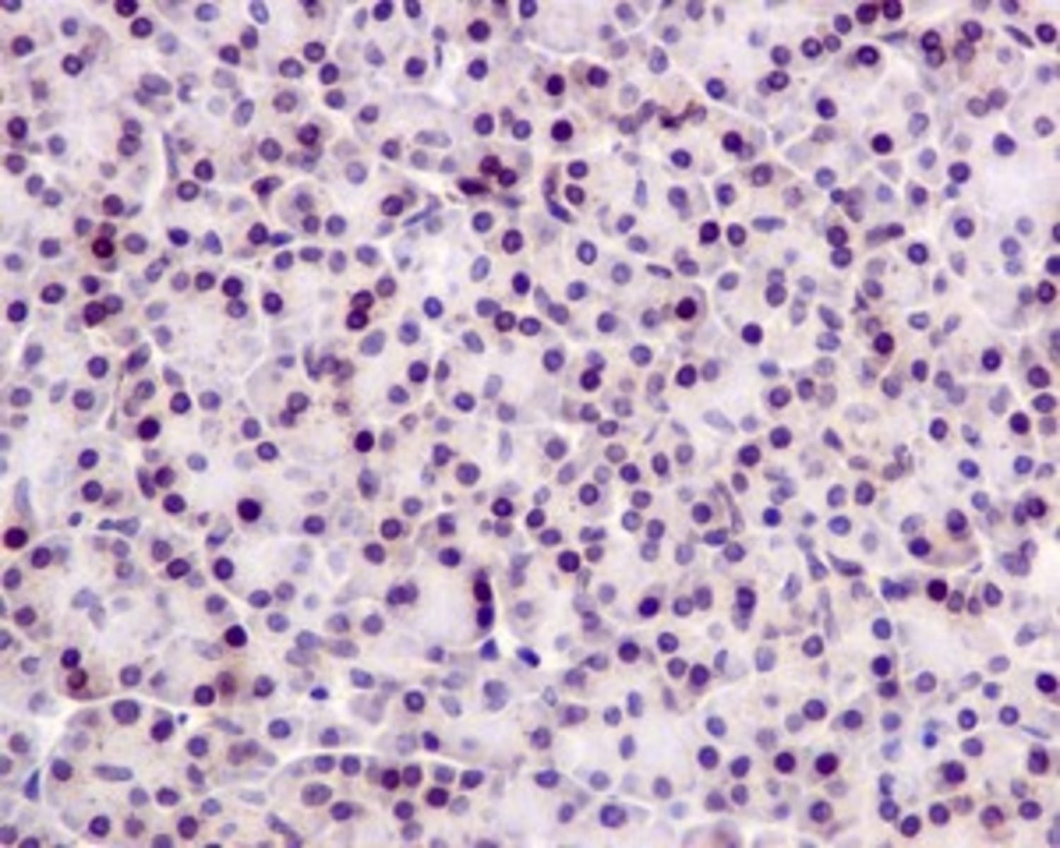 Anti-TSEN54 Rabbit Monoclonal Antibody [clone: EPR10062] | VWR, part of ...