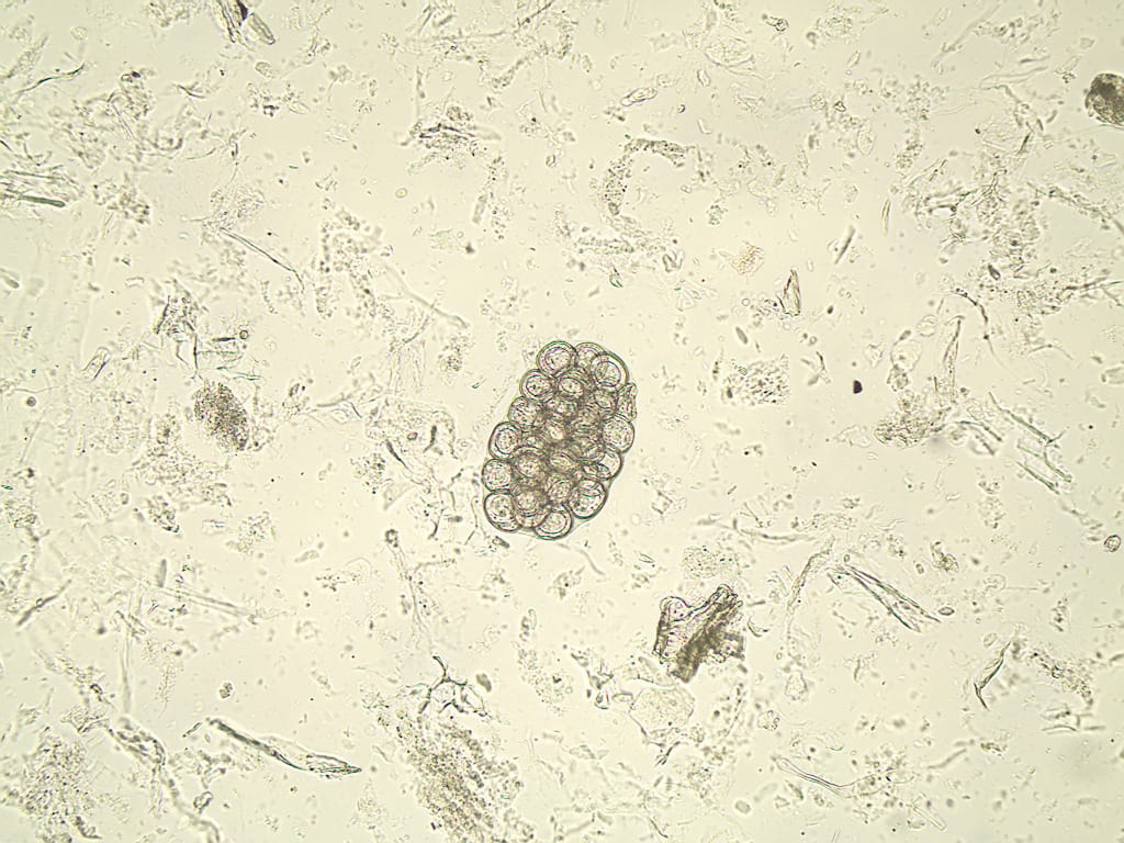Dipylidium caninum, Eggs Slide