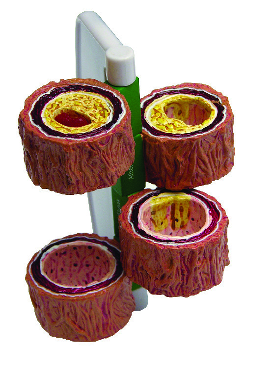 GPI Anatomicals® Artery Model