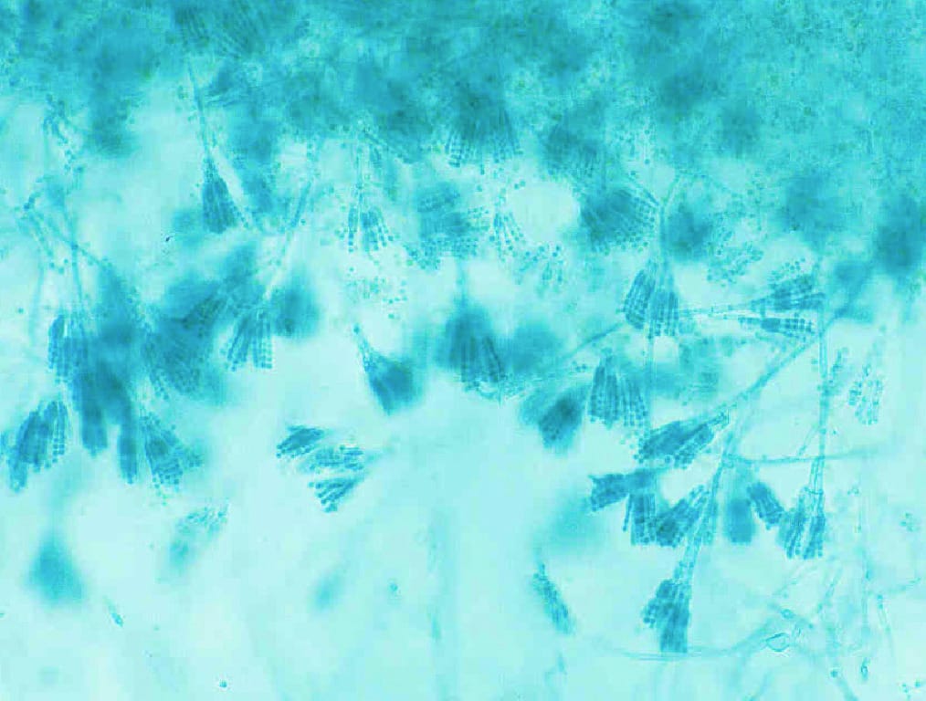 Ward's® Penicillium, Conidiophore with Conidia Slide