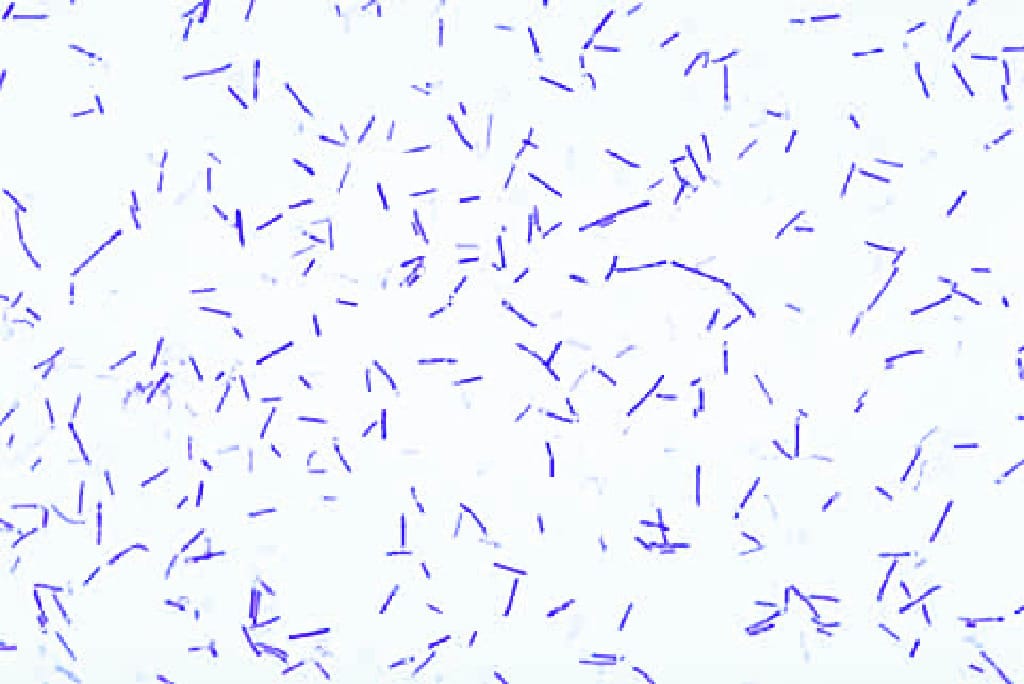 Clostridium botulinum