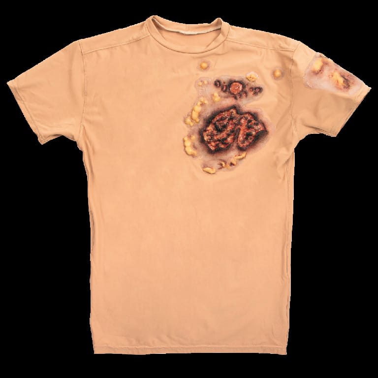 STOPS® Wound Clothing