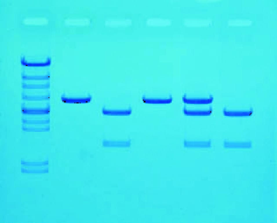Cholesterol Diagnostic Lab Activity