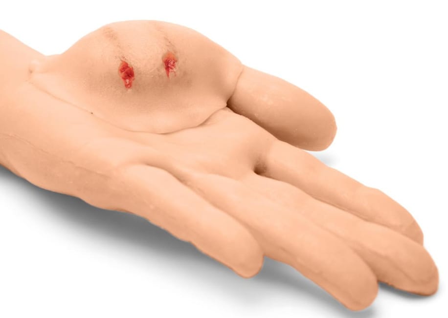 Medicor® Sticky Wounds