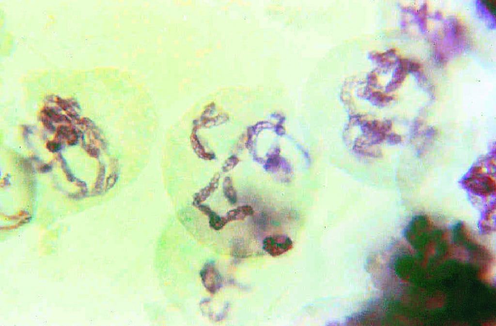 Lily Meiosis, First Meiotic Division Slide