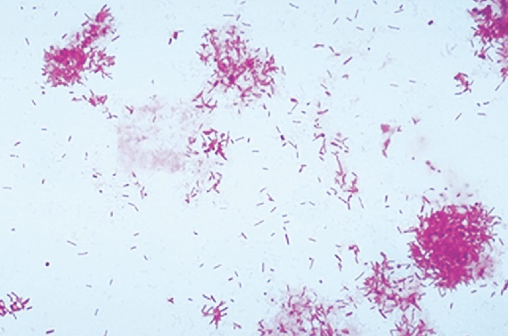 Ward's® Live Pseudomonas aeruginosa culture (Pathogenic)
