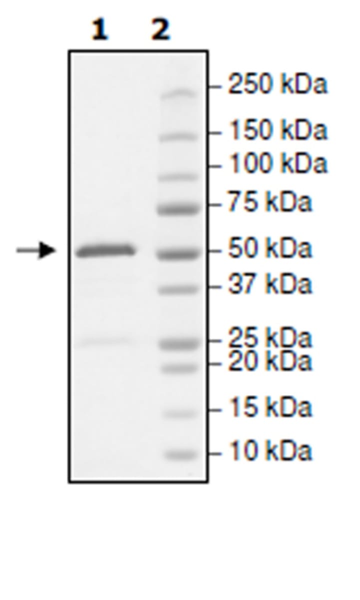 Human Recombinant Eph receptor A4/SEK (from Baculovirus (Sf9 Insect ...