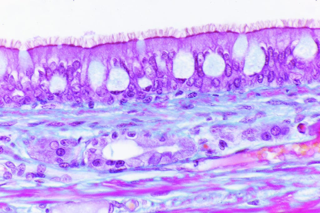 Pseudostratified, Ciliated, Columnar Epithelium Slides