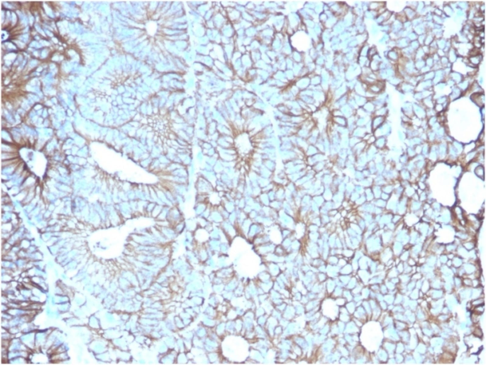 Anti-LI Cadherin Mouse Monoclonal Antibody [clone: CDH17/2617] | VWR ...