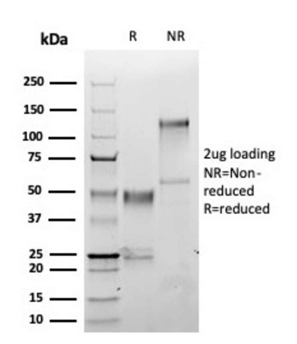Anti-S100A1 Rabbit Monoclonal Antibody [clone: S100A1/6374R] | VWR ...