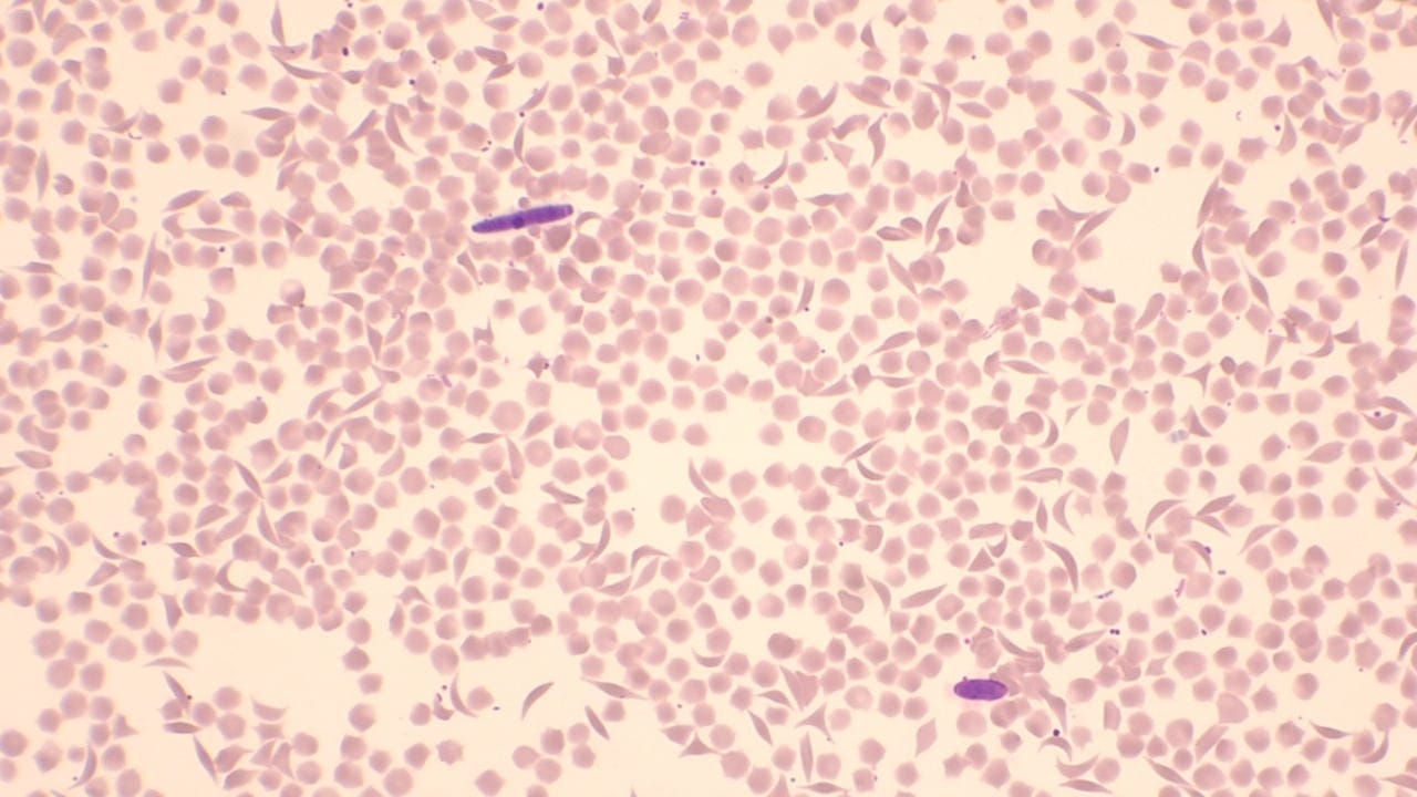Deer Blood Slide