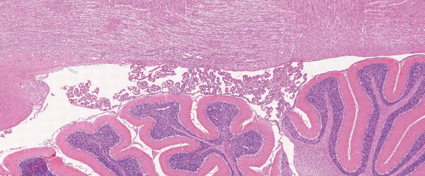 Cerebellum and Choroid Plexus Slide