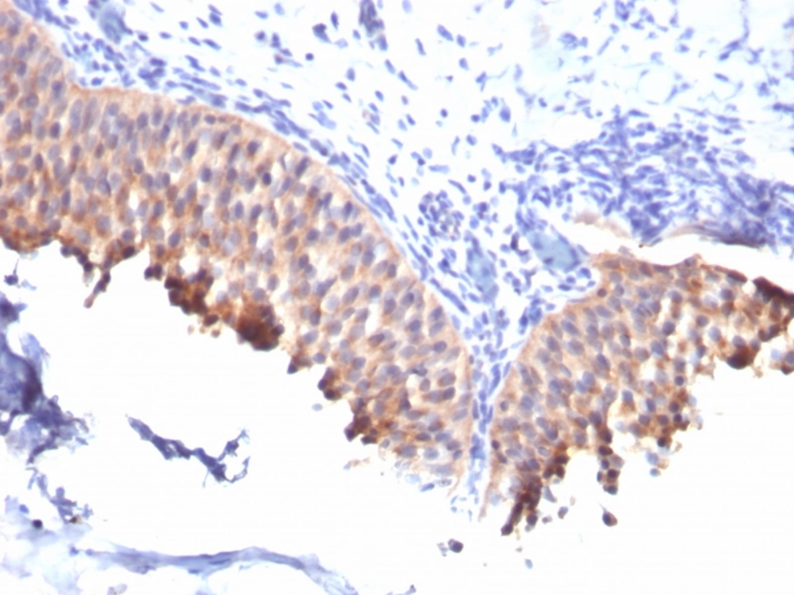 Anti-Cytokeratin 10 Mouse Monoclonal Antibody [clone: SPM261] | VWR ...