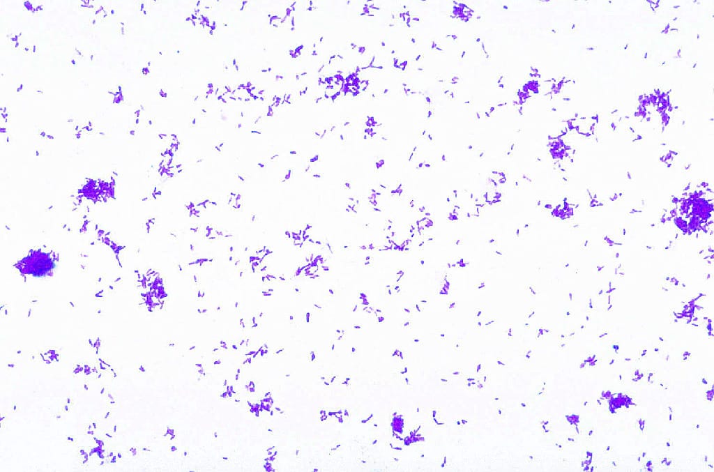 Agrobacterium tumefaciens smear, Gram (-) Slides