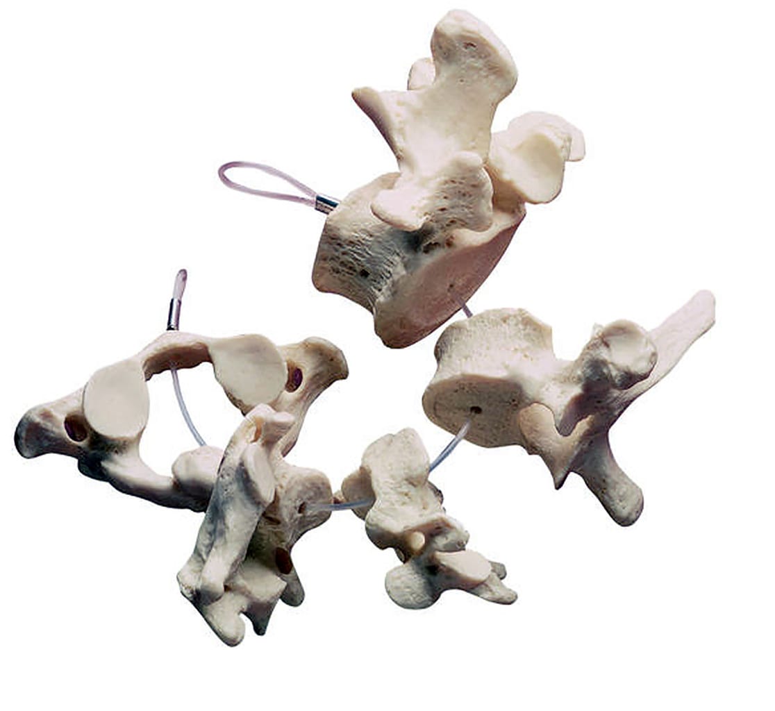 Somso® Collection of Vertebrae