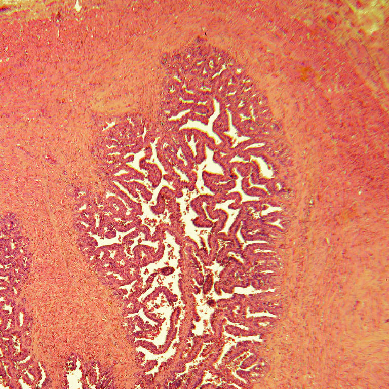 Seminal Vesicle, Human Slide