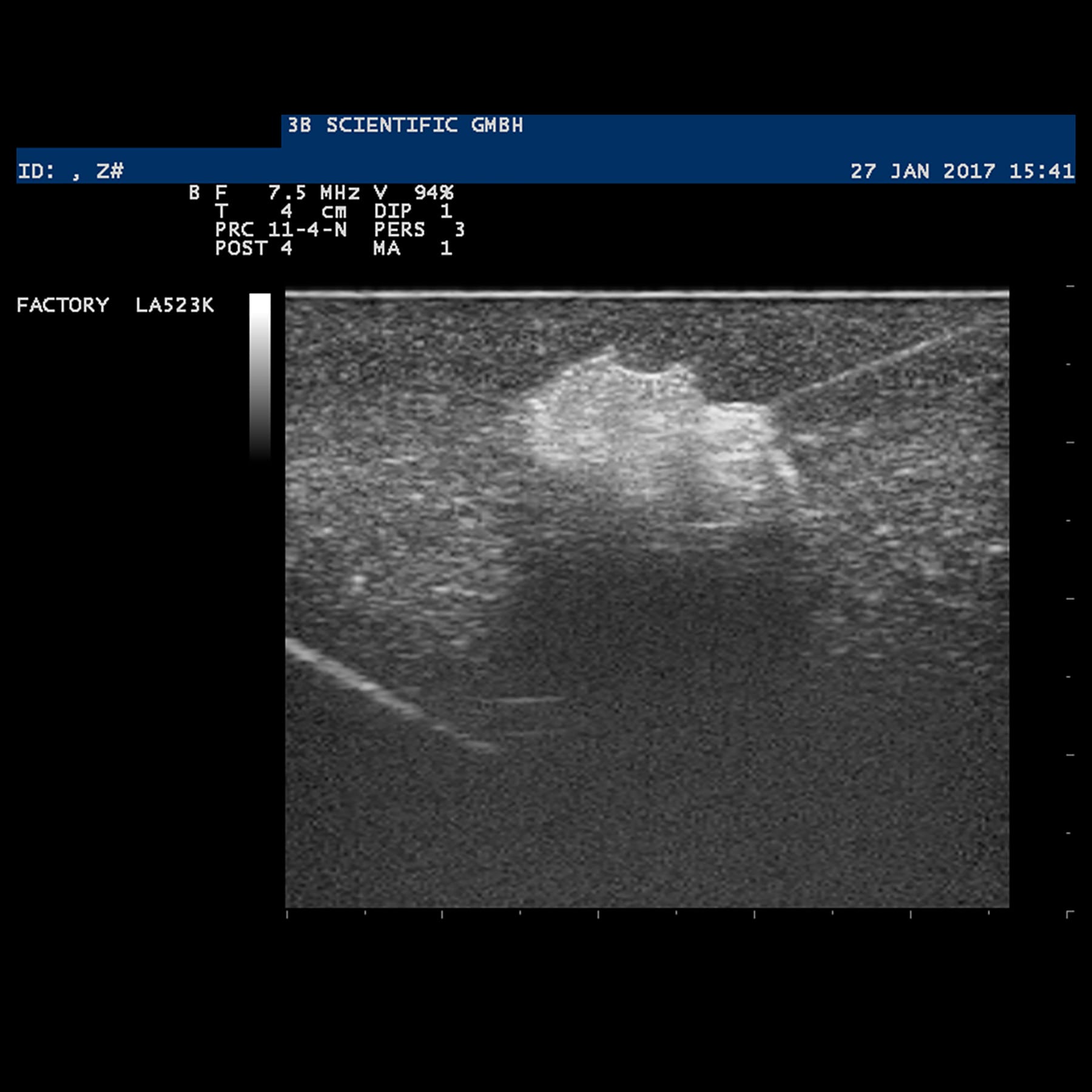 3B Scientific® SONOtrain™ Ultrasound Breast Phantoms