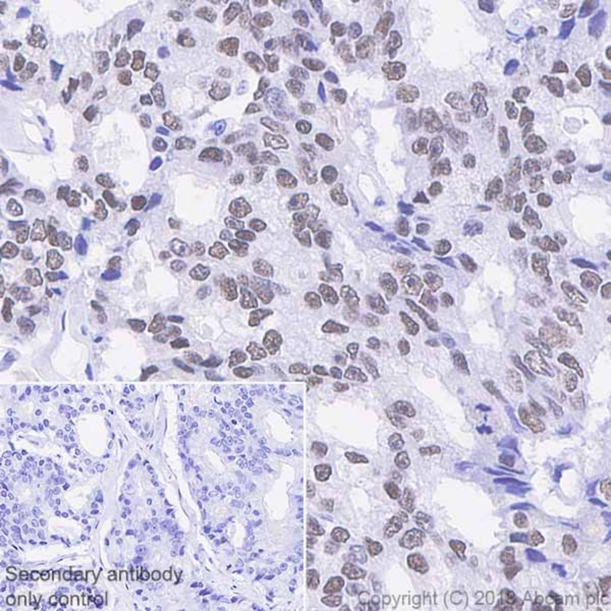 Anti-Androgen Receptor Rabbit Monoclonal Antibody [clone: SP242] | VWR ...