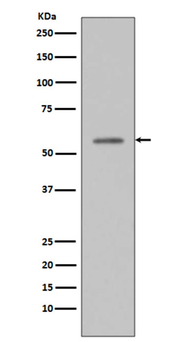 Anti-TP53 (Phospho-S33) Rabbit Monoclonal Antibody [clone: ACD-20 ...