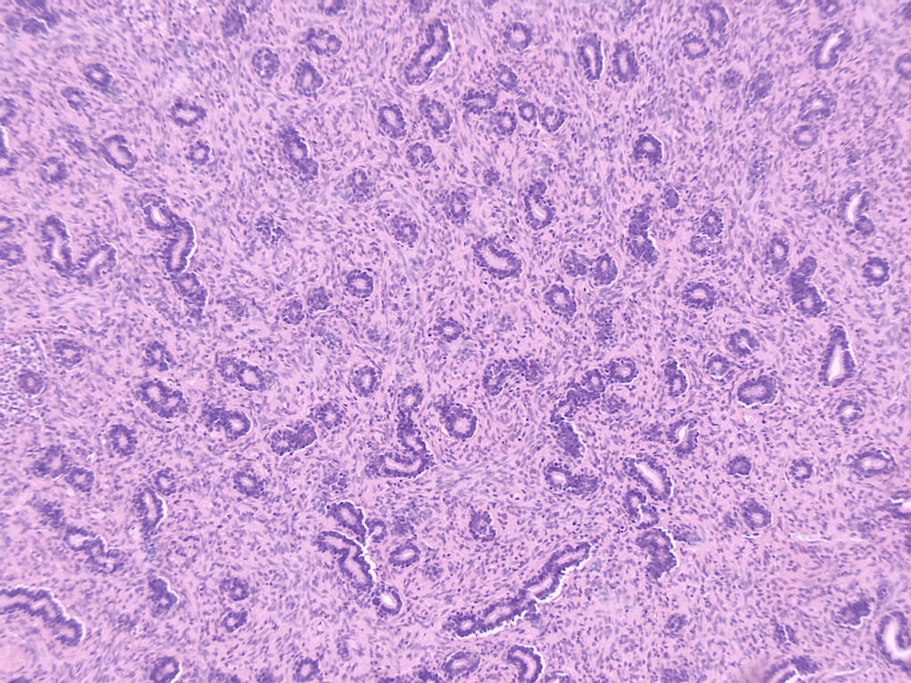 Prostate, Primate Slide