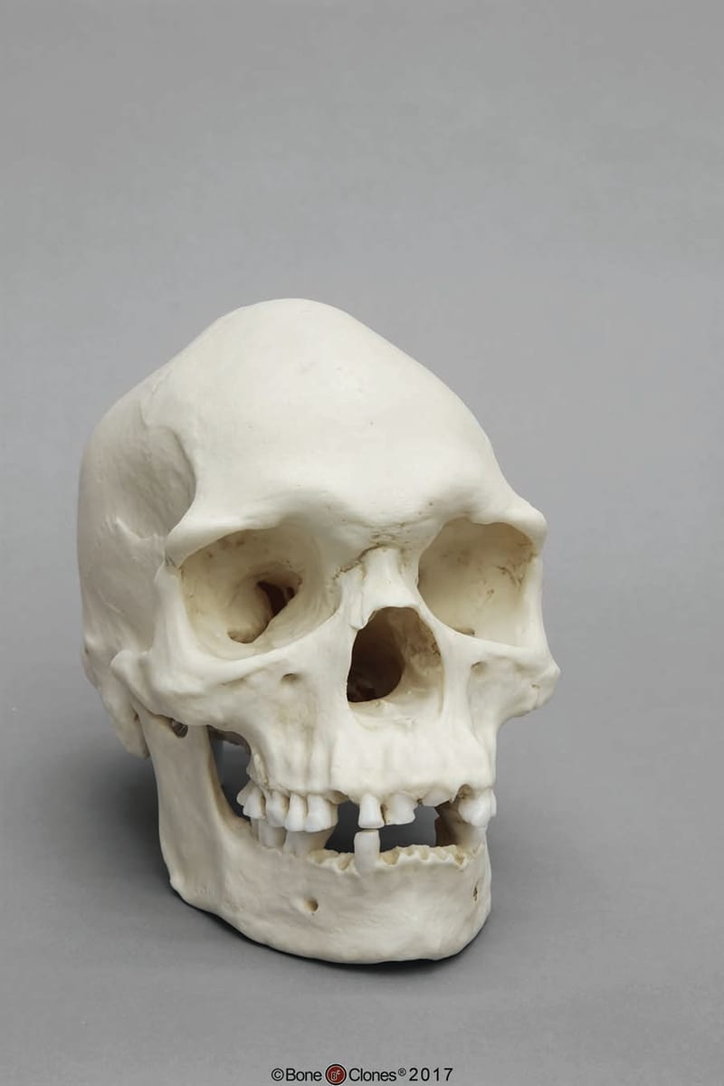 BoneClones® Regional Human Skulls