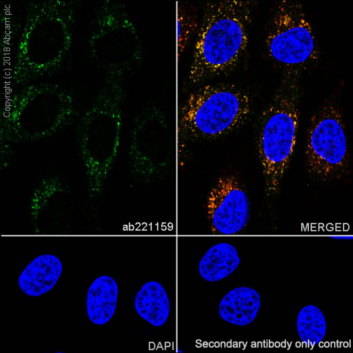 Anti-ABCB6/PRP Rabbit Monoclonal Antibody [clone: EPR21891] | VWR, part ...