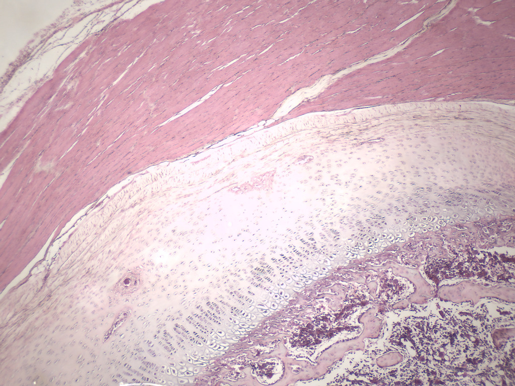 Muscle-Bone Connection Slide
