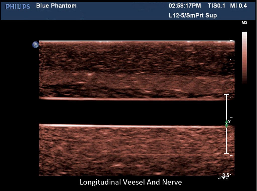 Blue Phantom® Ultrasound Training Block Models
