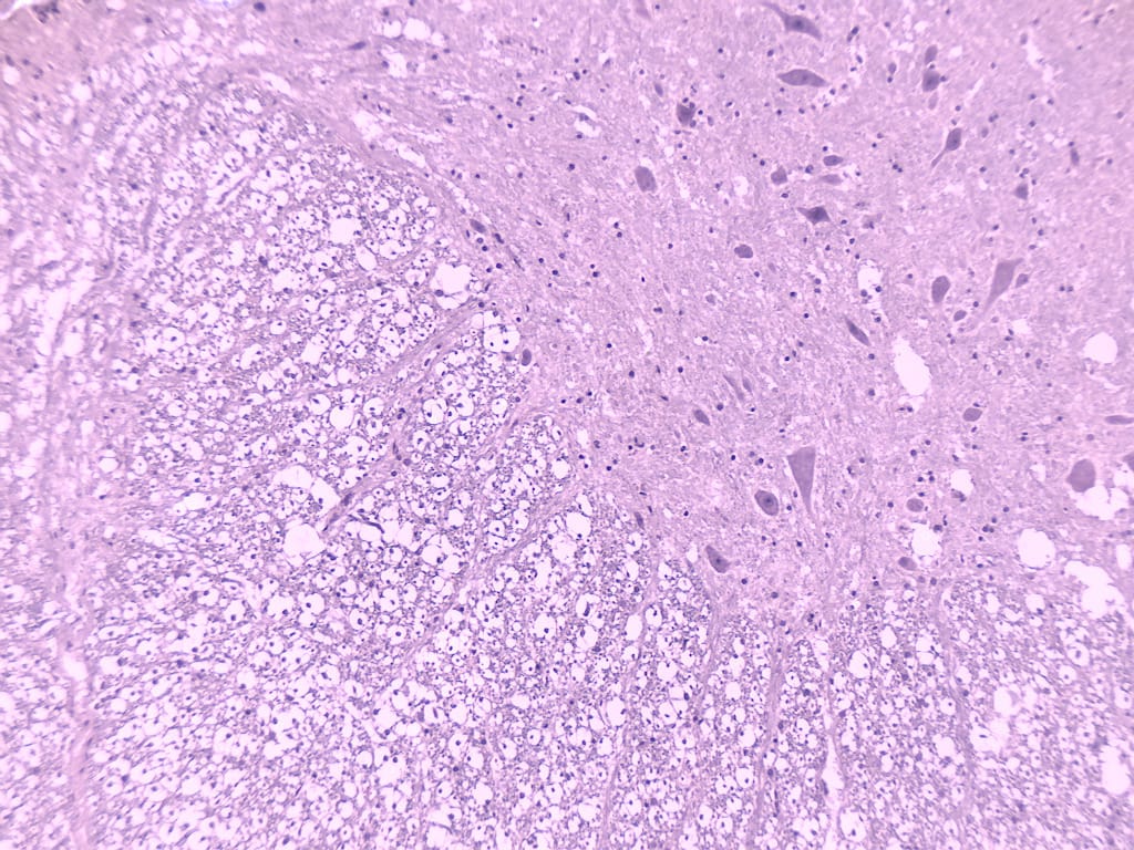 Spinal Cord Slide