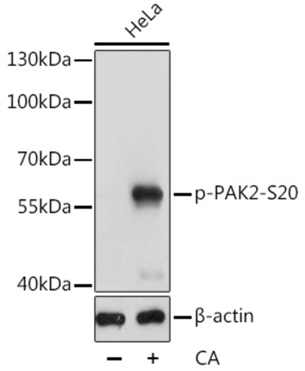 Anti-PAK2 (phospho Ser20) Rabbit Polyclonal Antibody | VWR, part of Avantor