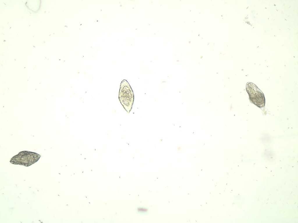 Schistosoma haematobium, Eggs Slide