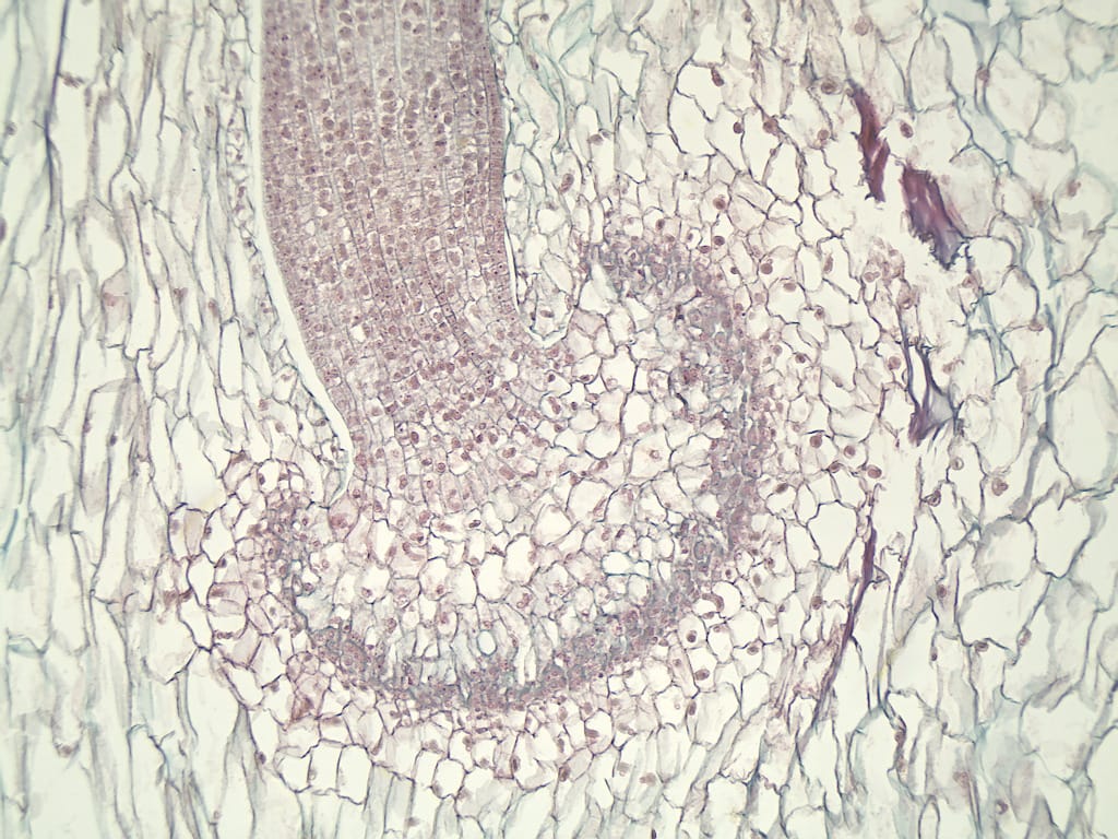 Anthoceros, Sporophyte Slide