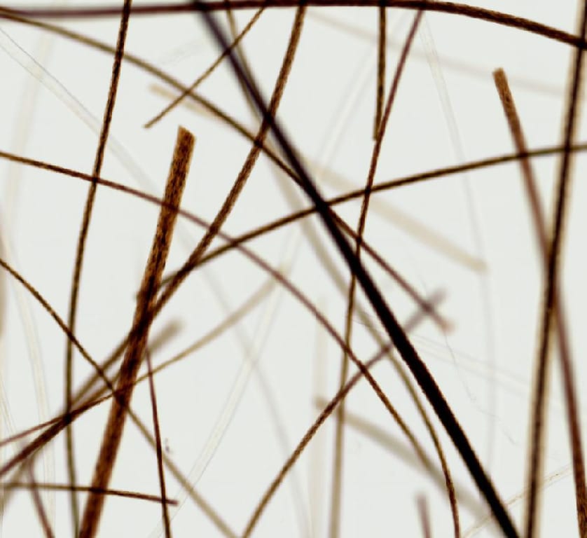 Ward's® Whole-Mounted Hair Slides