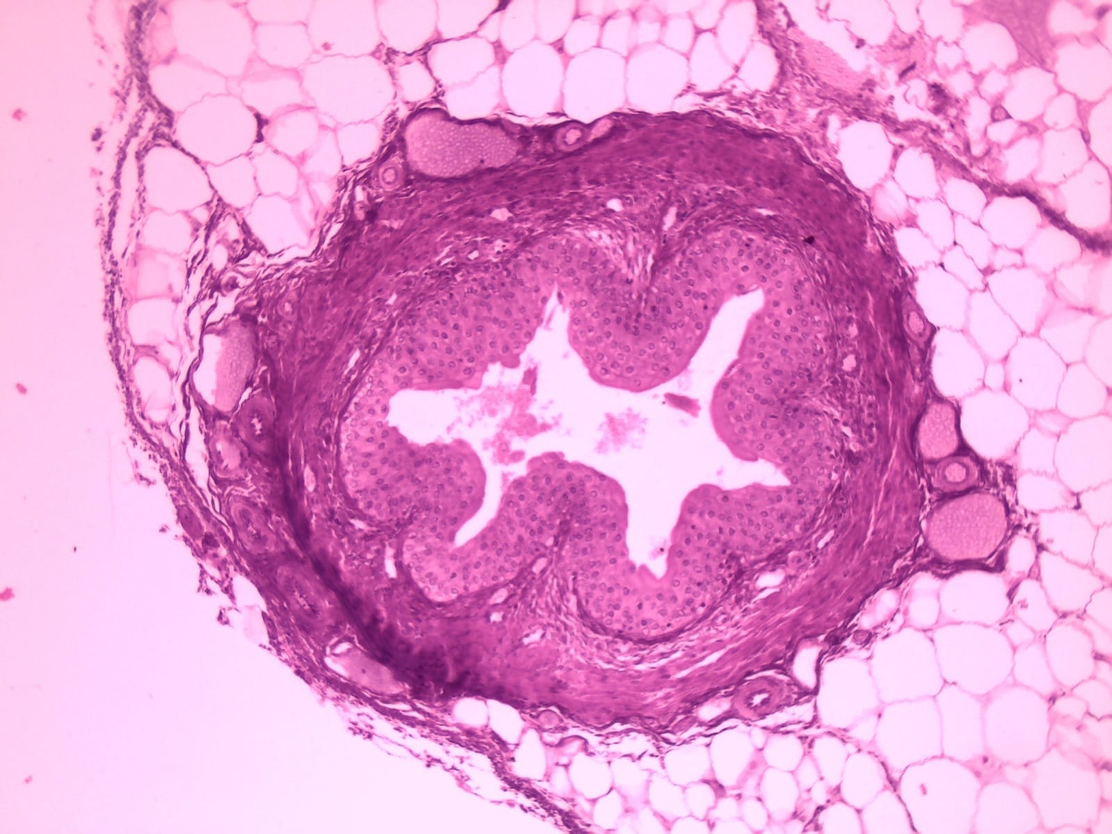 Ureter, Mammal Slide