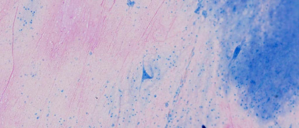 Giant Multipolar Motor Neurons