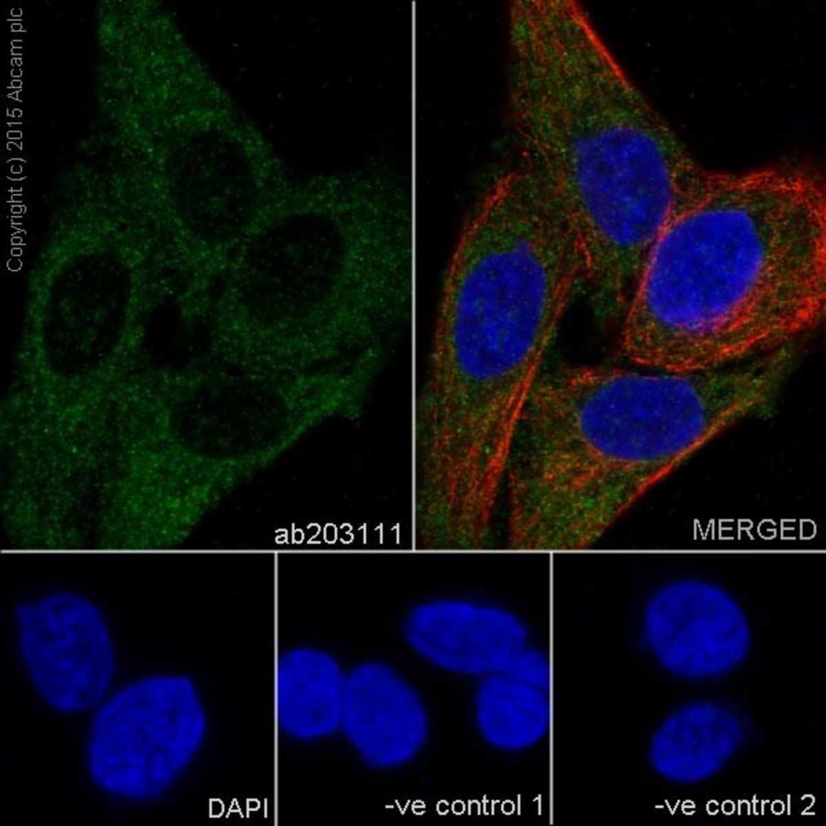 Anti-PPCEL/PREPL Rabbit Monoclonal Antibody [clone: EPR17752] | VWR ...