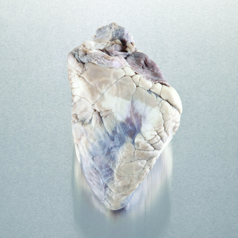 Ward's® Pure Preserved™ Hearts without Pericardium