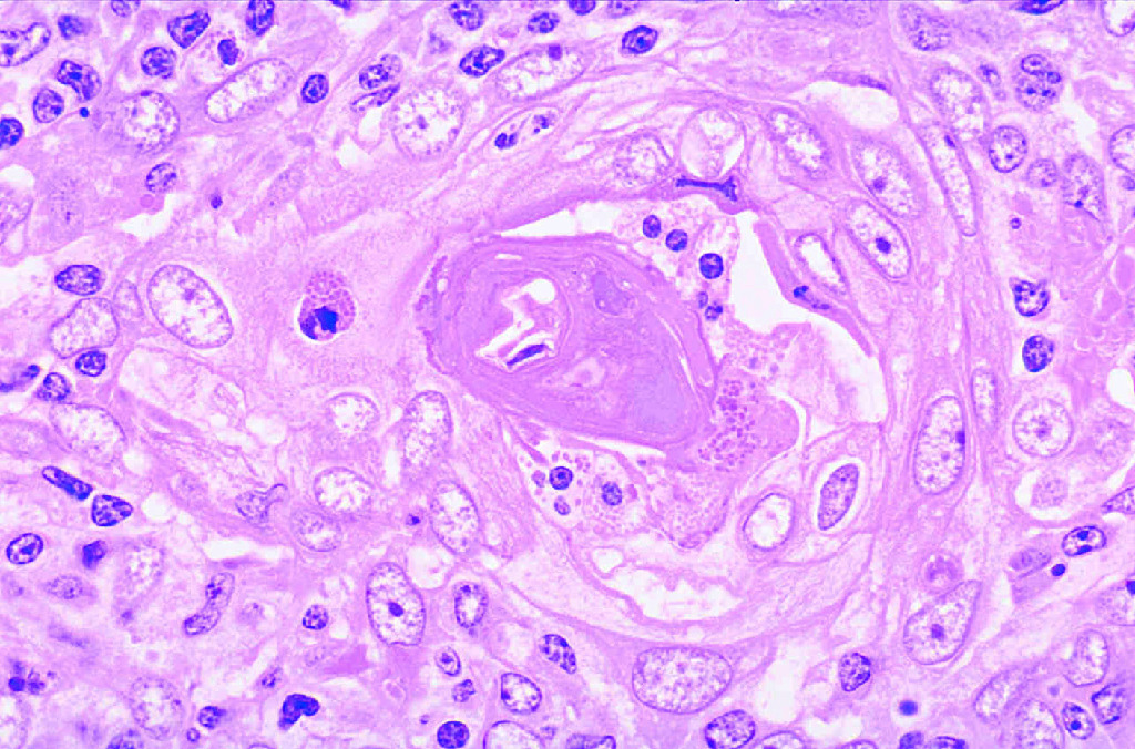 Thymus, Thin Section Slide