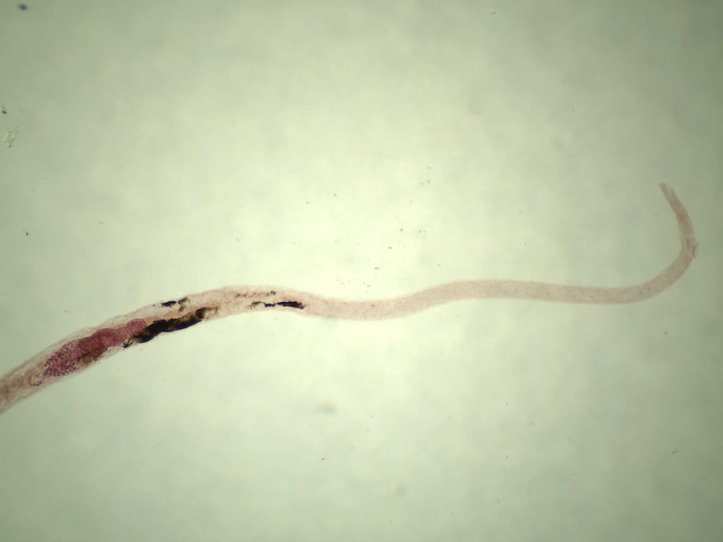 Schistosoma manson, Female Slide