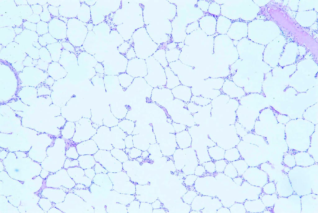 Lung, Mammal Slide