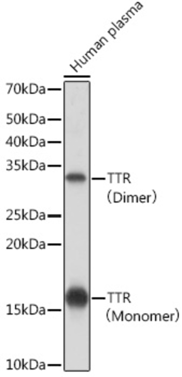 Anti-Prealbumin Rabbit Monoclonal Antibody [clone: ARC0892] | VWR, part ...