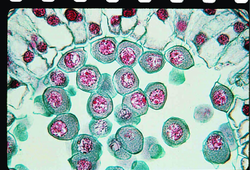 Lily Meiosis, Early Prophase Slide