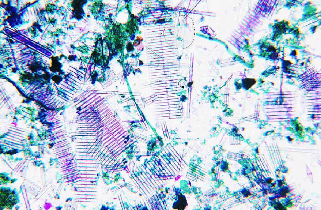 Mixed Diatoms Slide