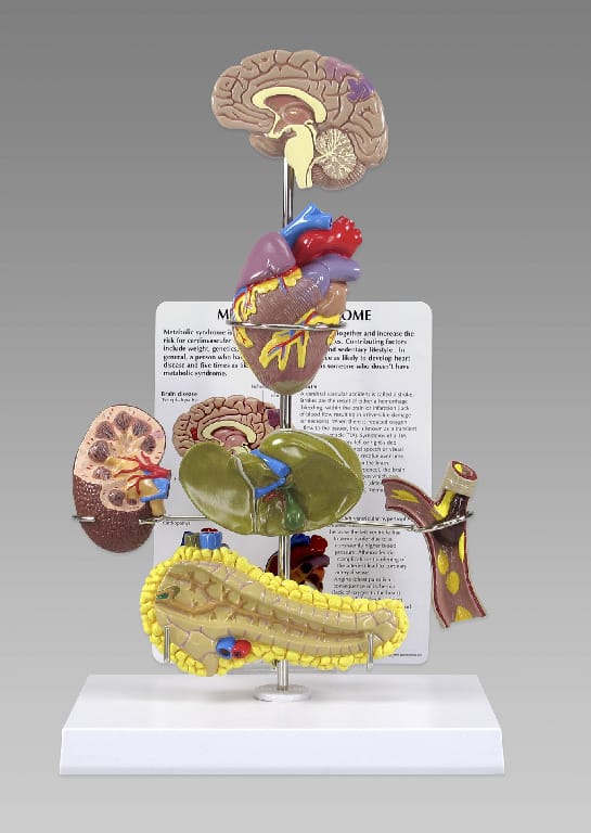 GPI Anatomicals® Metabolic Syndrome Model