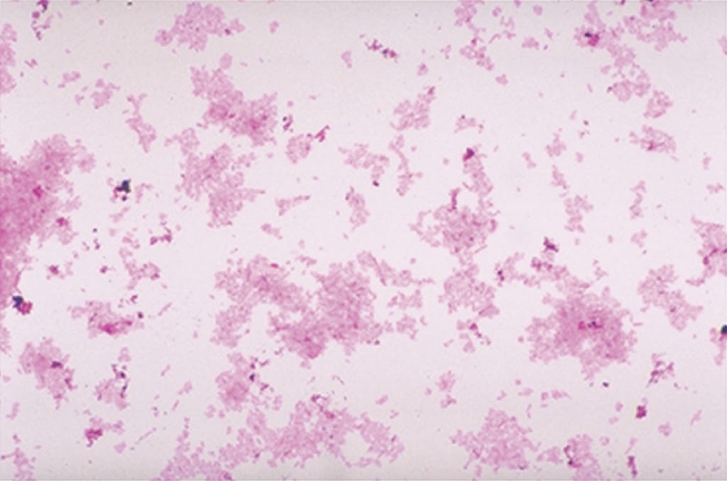 Ward's® Live Rhizobium leguminosarum Culture