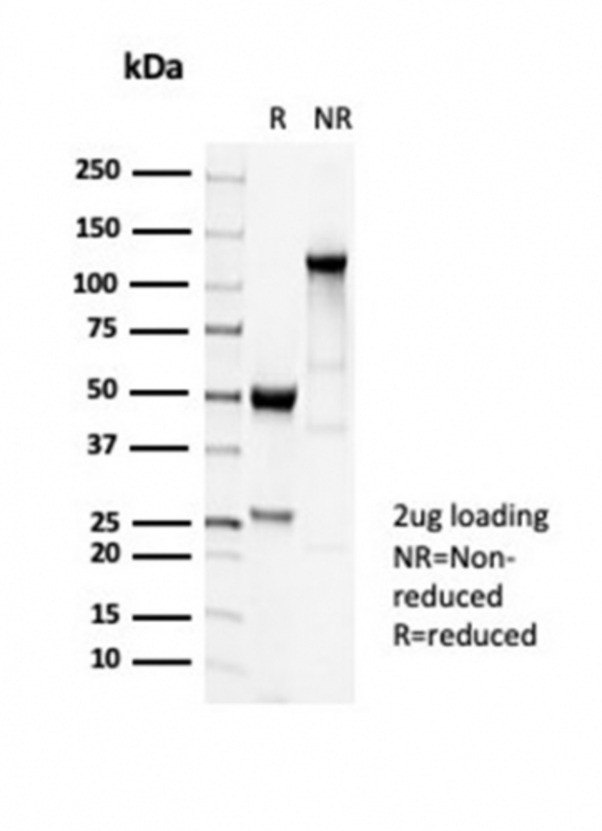 Anti-beta III Tubulin Rabbit Recombinant Antibody [Clone: TUBB3/7089R ...