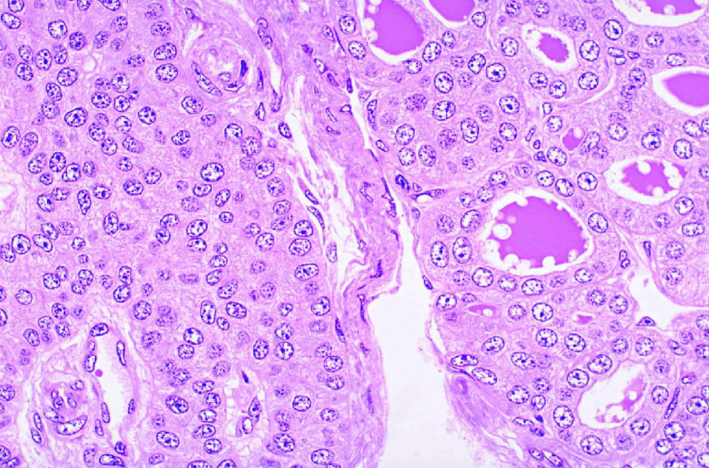 Thyroid and Parathyroid