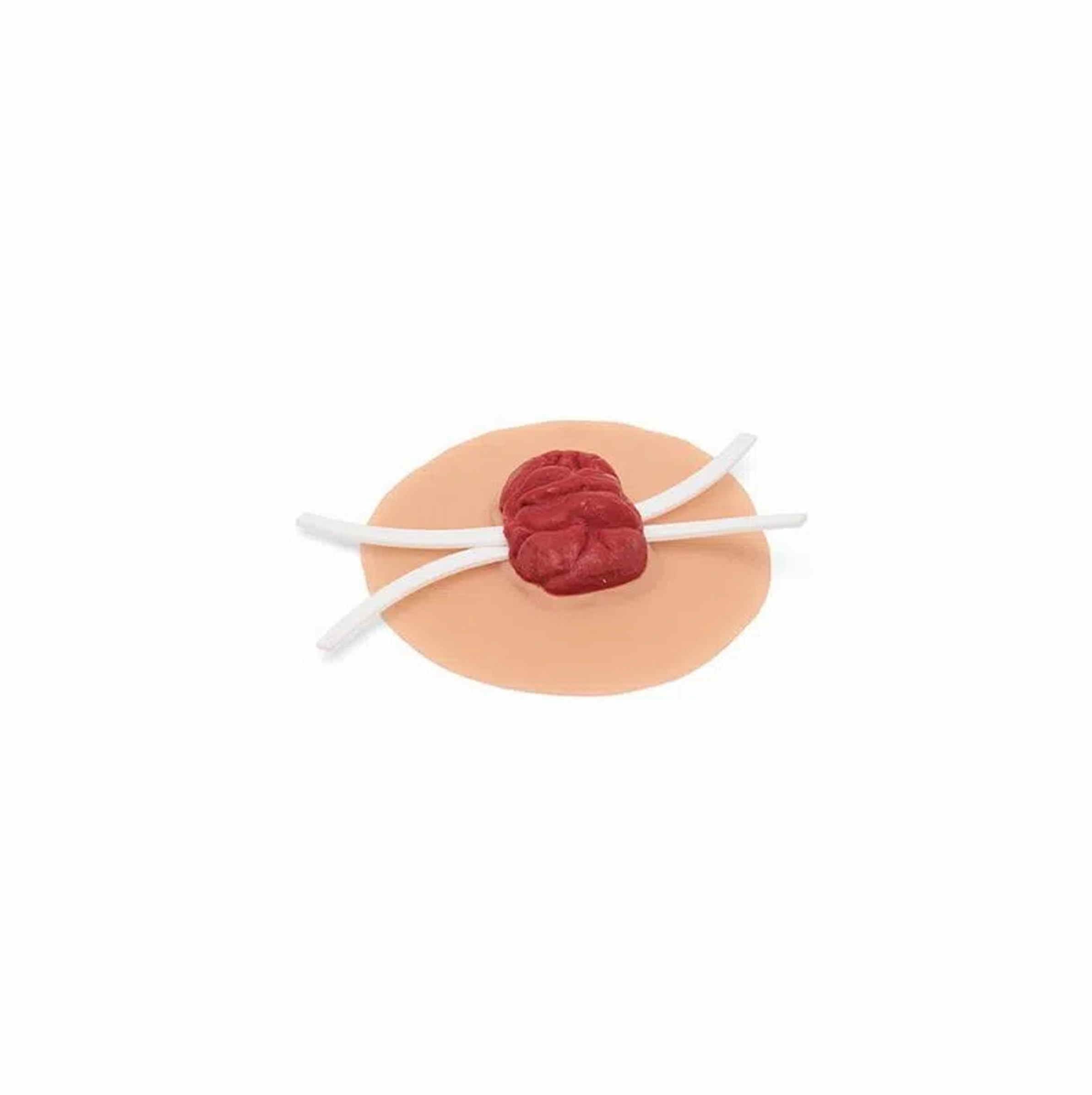 Medicor® Sticky Wounds