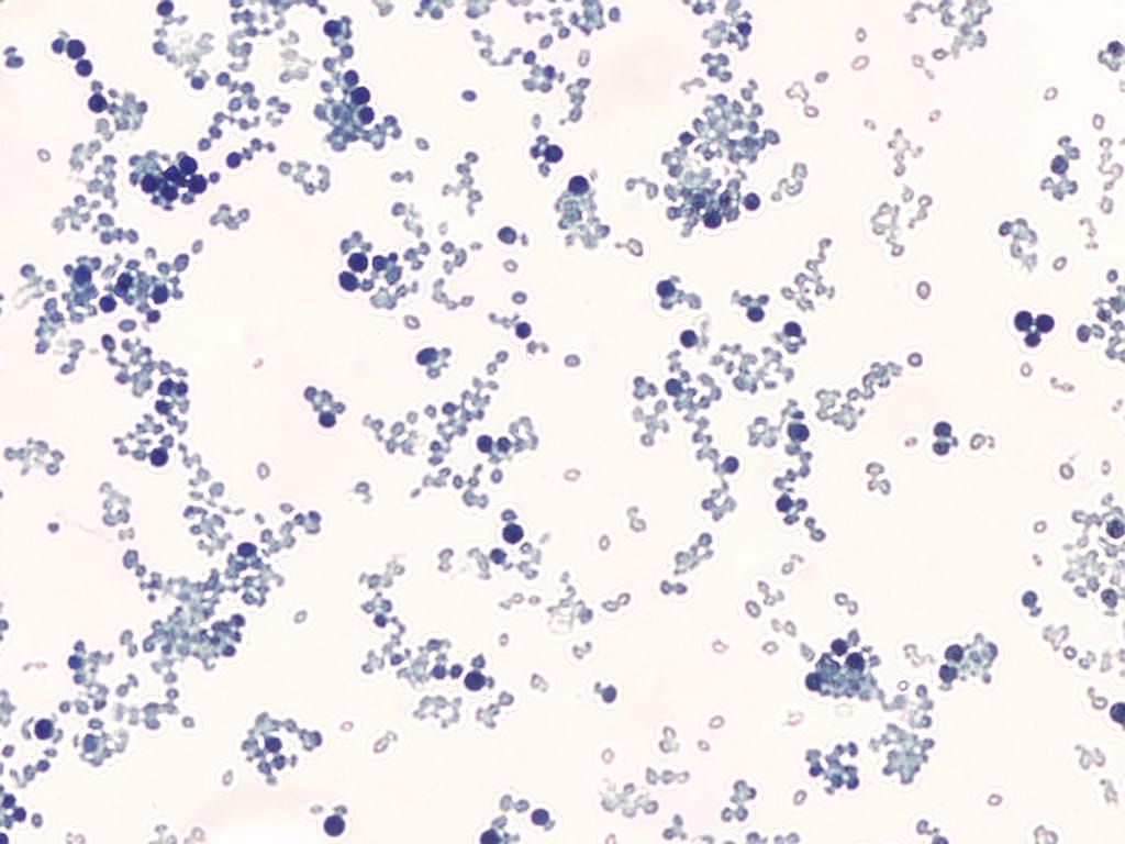 Yeast, Three Types Slide